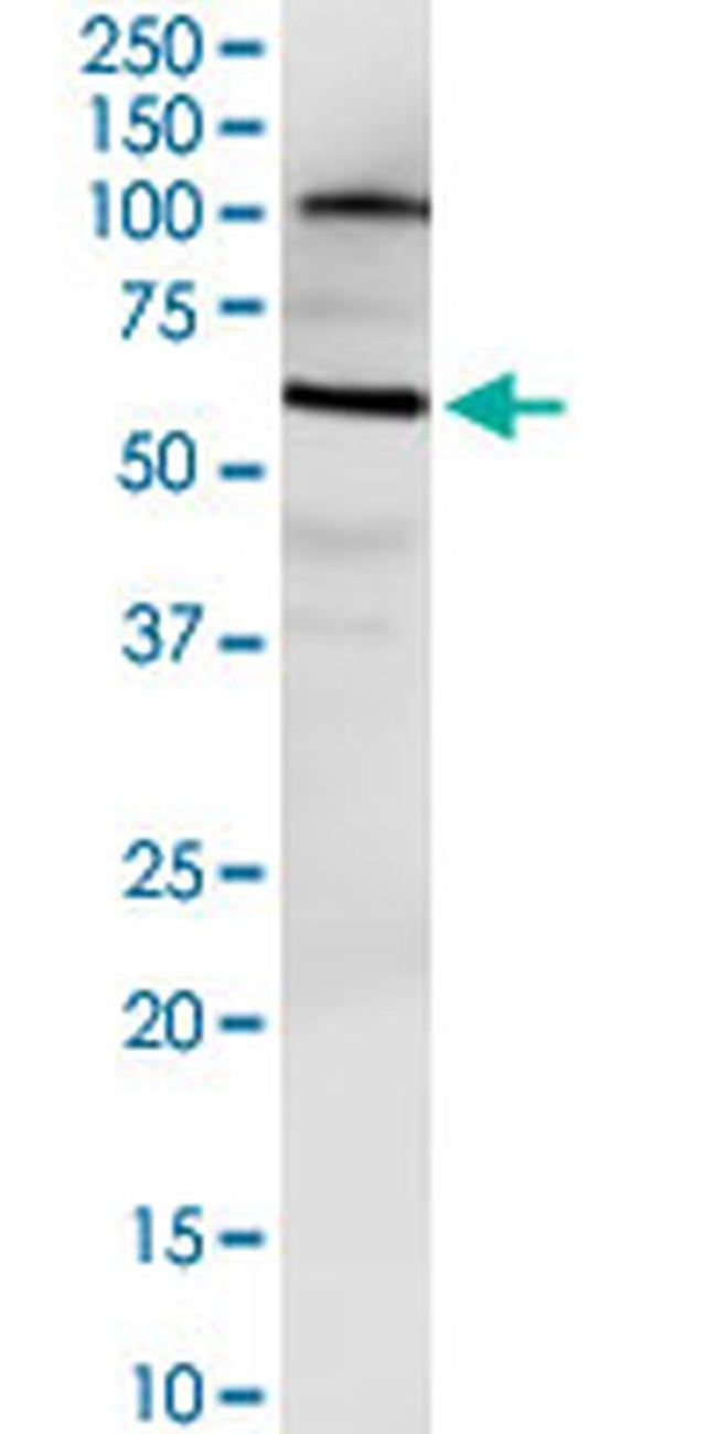 NUDT12 Antibody in Western Blot (WB)