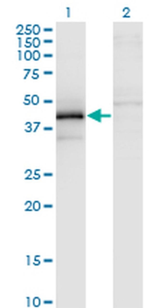 ZFYVE19 Antibody in Western Blot (WB)