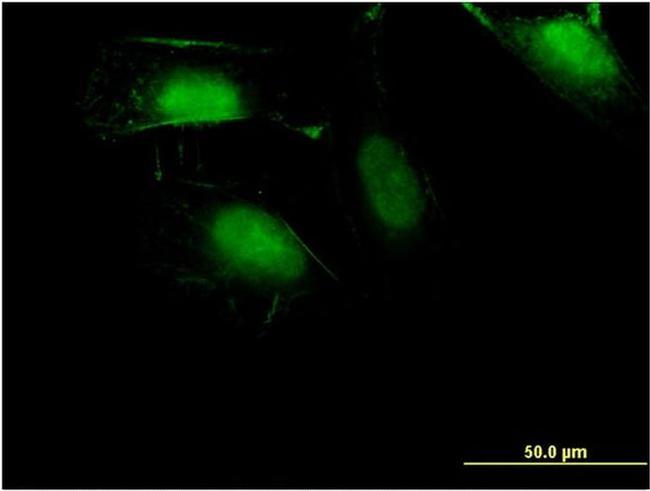 ZNF598 Antibody in Immunocytochemistry (ICC/IF)