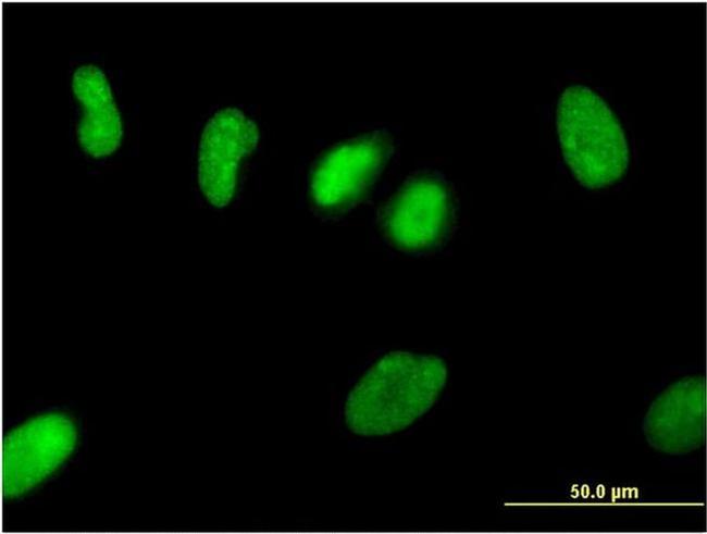 ZNF101 Antibody in Immunocytochemistry (ICC/IF)