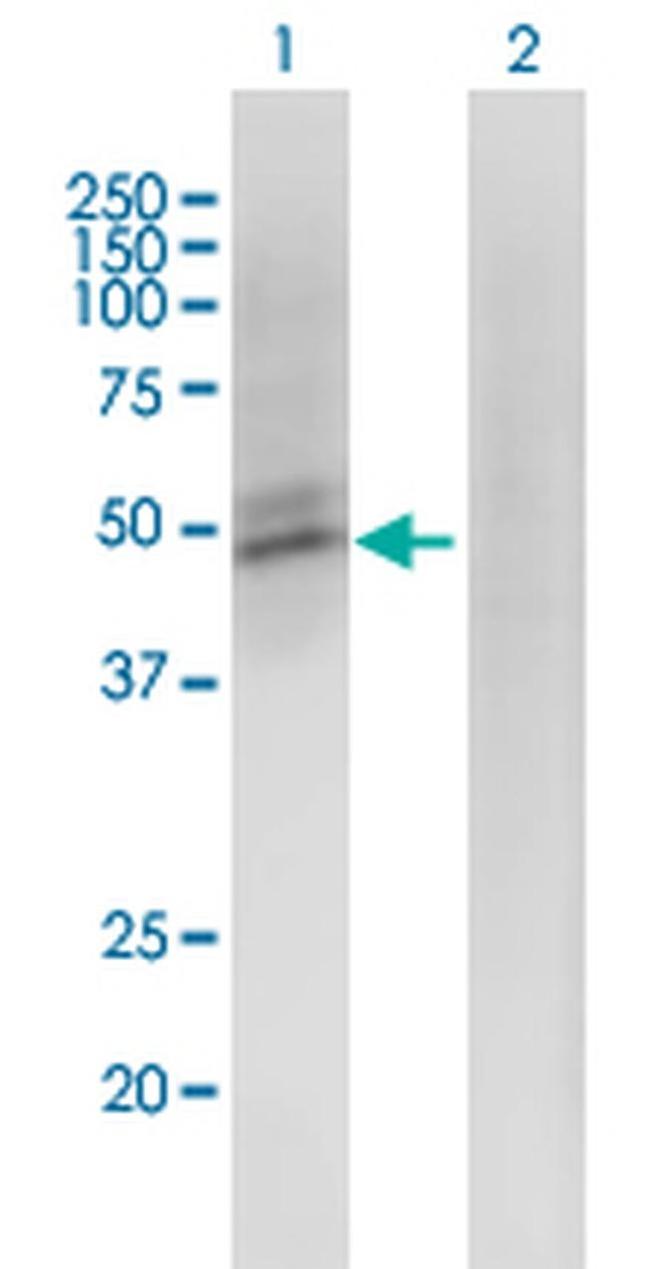 ACMSD Antibody in Western Blot (WB)