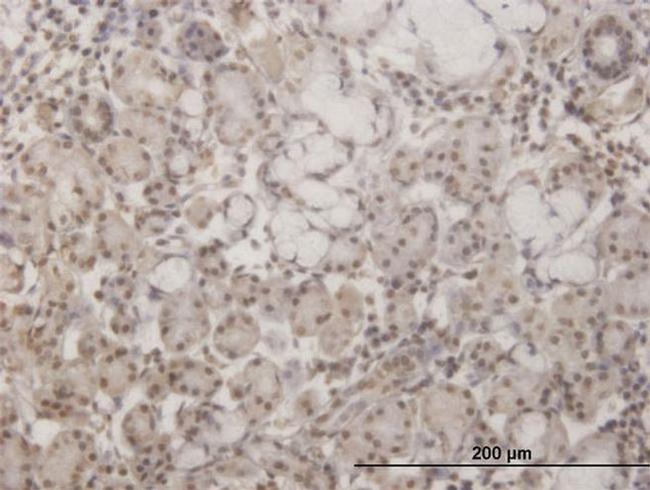 GSC Antibody in Immunohistochemistry (PFA fixed) (IHC (PFA))