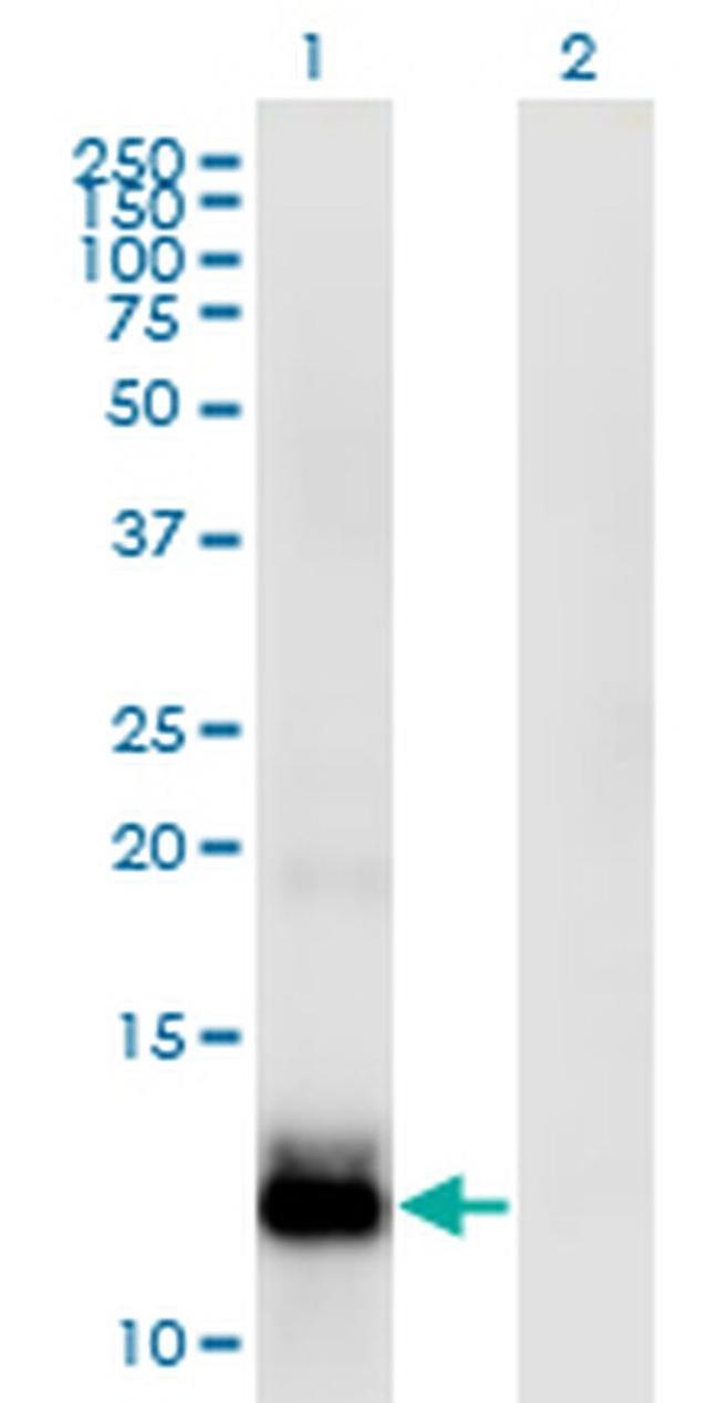 WFDC5 Antibody in Western Blot (WB)