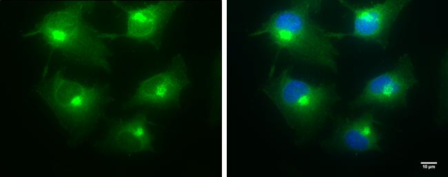 BICD2 Antibody in Immunocytochemistry (ICC/IF)