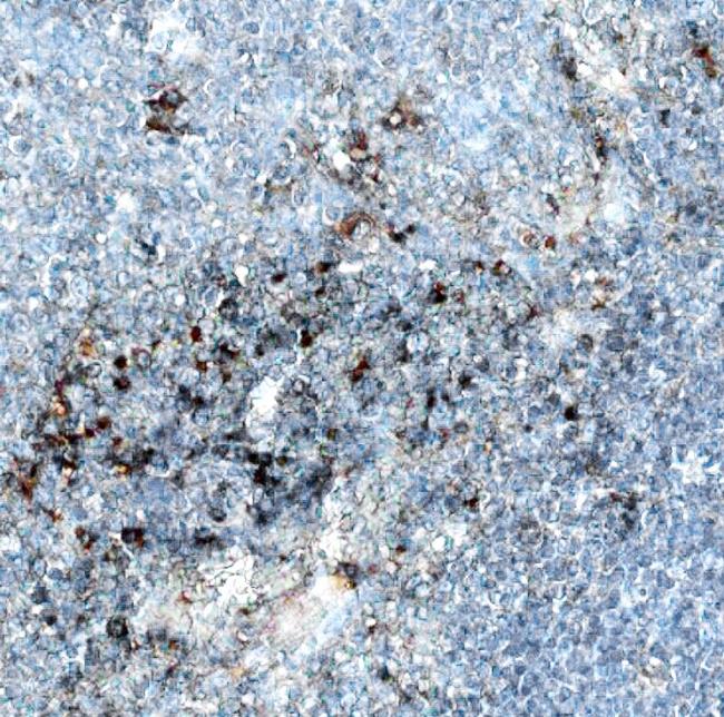 CD154 (CD40 Ligand) Antibody in Immunohistochemistry (Paraffin) (IHC (P))