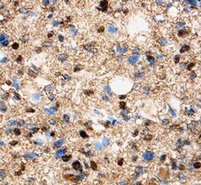 OLIG1 Antibody in Immunohistochemistry (Paraffin) (IHC (P))