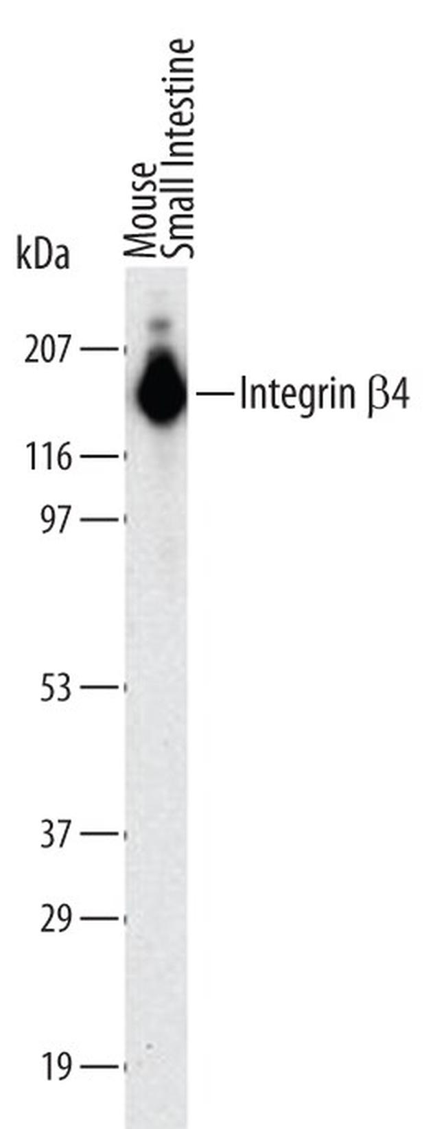 CD104 Antibody in Western Blot (WB)