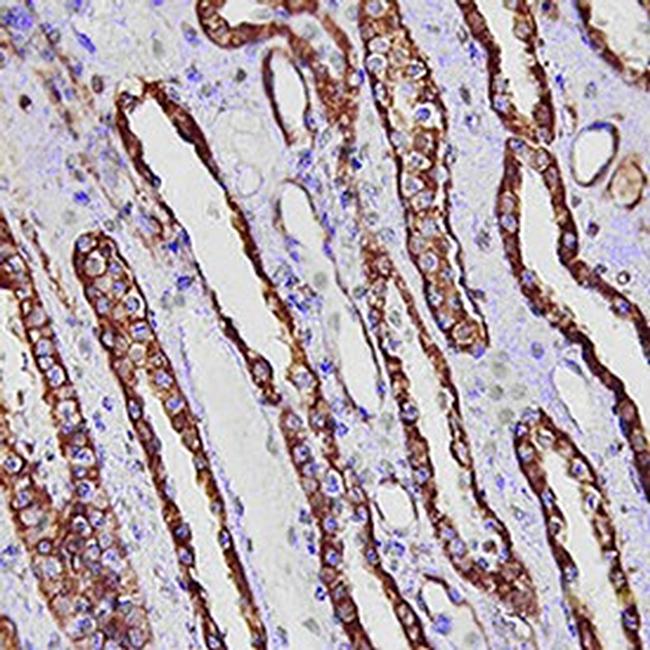 FABP1 Antibody in Immunohistochemistry (Paraffin) (IHC (P))