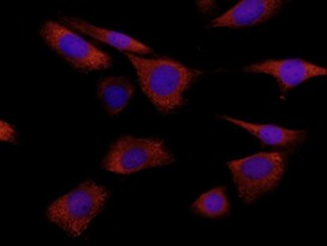 S100A8 Antibody in Immunocytochemistry (ICC/IF)