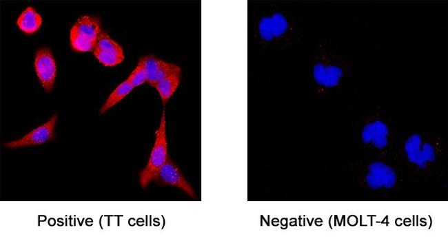 APLP1 Antibody in Immunocytochemistry (ICC/IF)