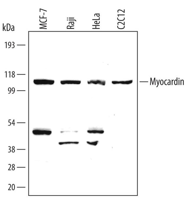 MYOCD Antibody in Western Blot (WB)