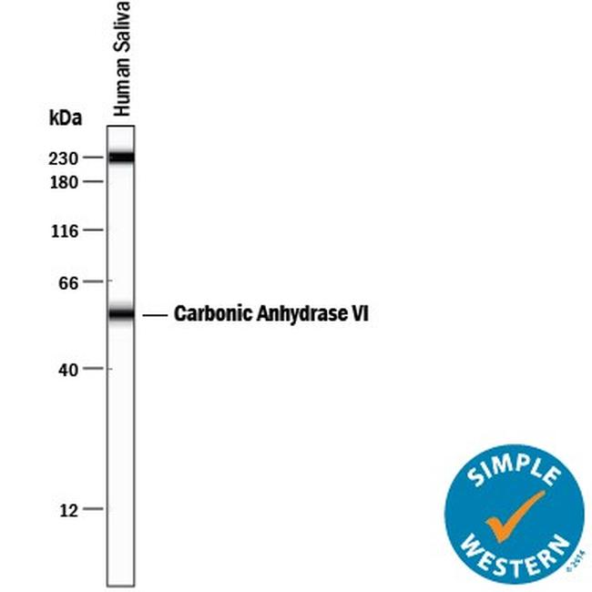 Carbonic Anhydrase VI Antibody in Western Blot (WB)