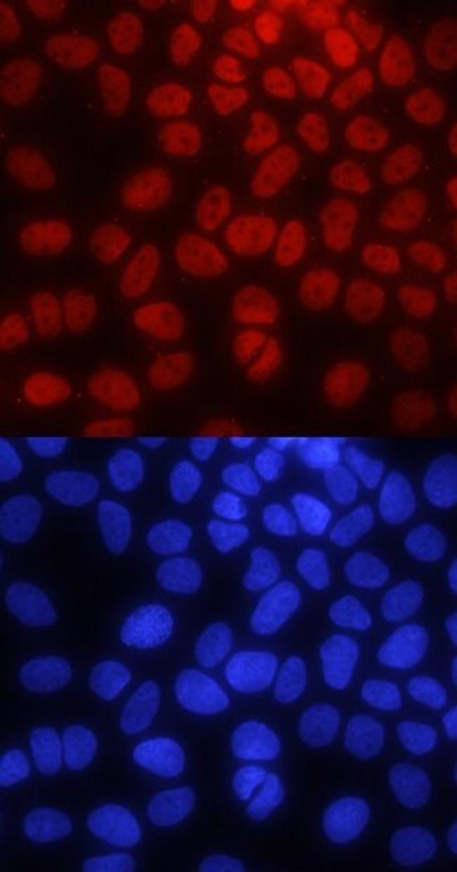 PYGO2 Antibody in Immunocytochemistry (ICC/IF)