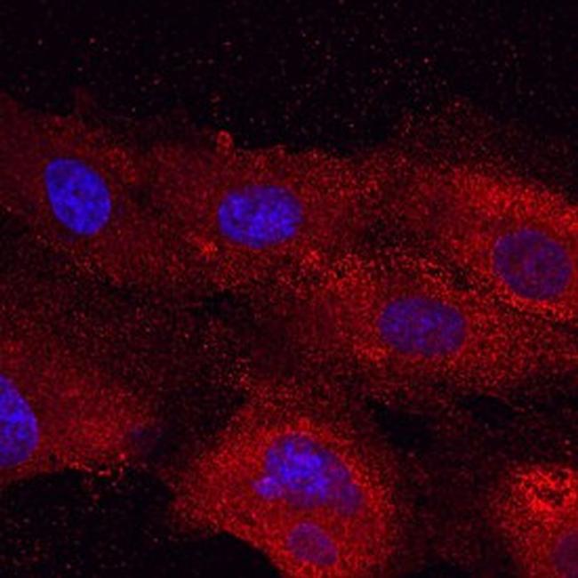 Plexin A2 Antibody in Immunocytochemistry (ICC/IF)