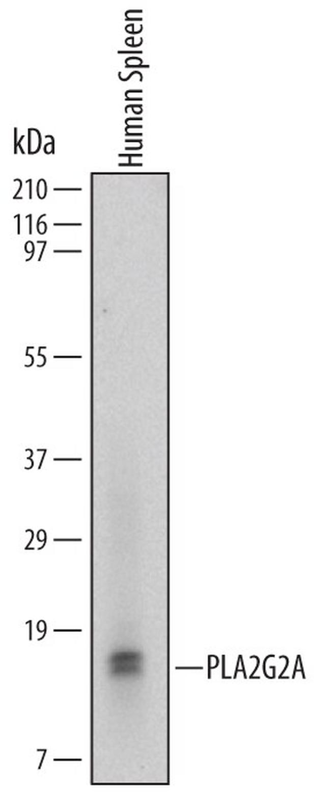 PLA2G2A Antibody in Western Blot (WB)