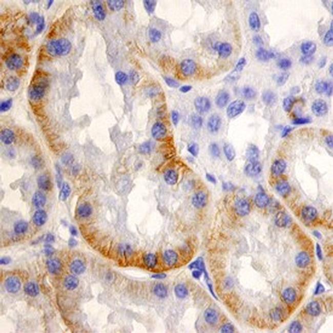 SLC22A2 Antibody in Immunohistochemistry (Paraffin) (IHC (P))