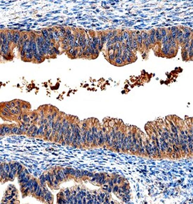 WFDC2 Antibody in Immunohistochemistry (Paraffin) (IHC (P))