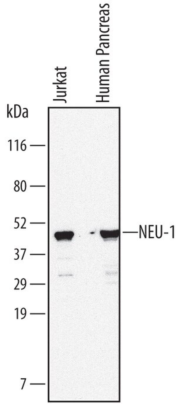 NEU1 Antibody in Western Blot (WB)