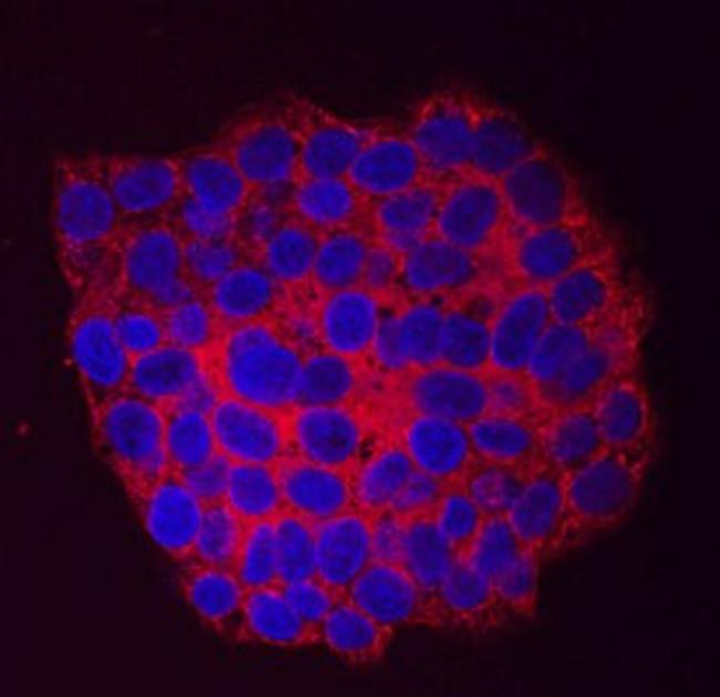 Arylsulfatase B Antibody in Immunocytochemistry (ICC/IF)