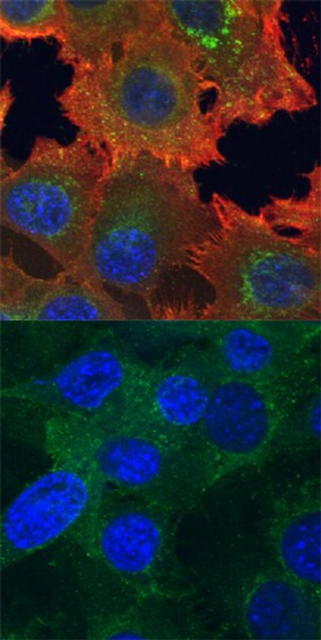 Phospho-Axl (Tyr779) Antibody in Immunocytochemistry (ICC/IF)