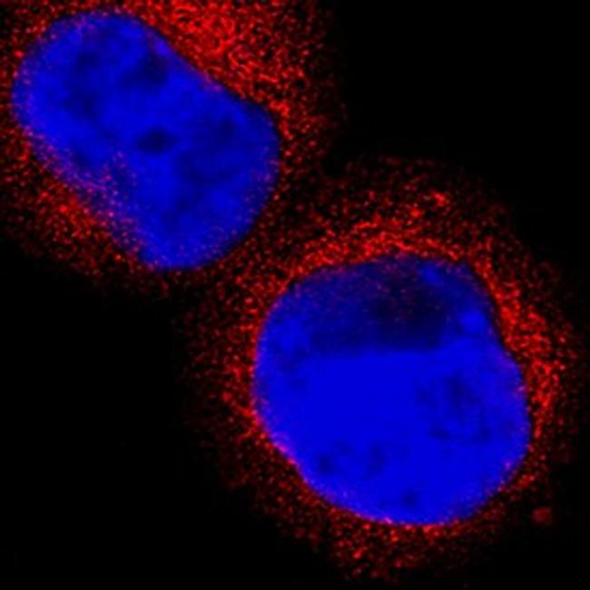 HPGDS Antibody in Immunocytochemistry (ICC/IF)