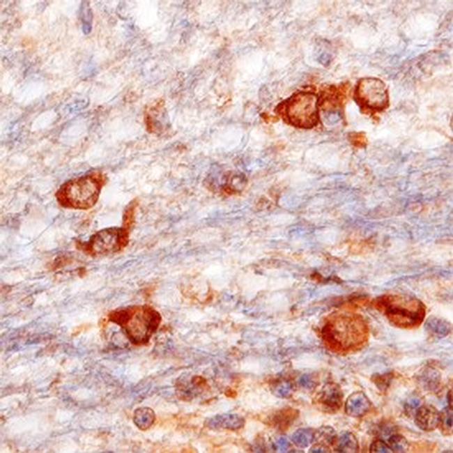 VAPB Antibody in Immunohistochemistry (Paraffin) (IHC (P))