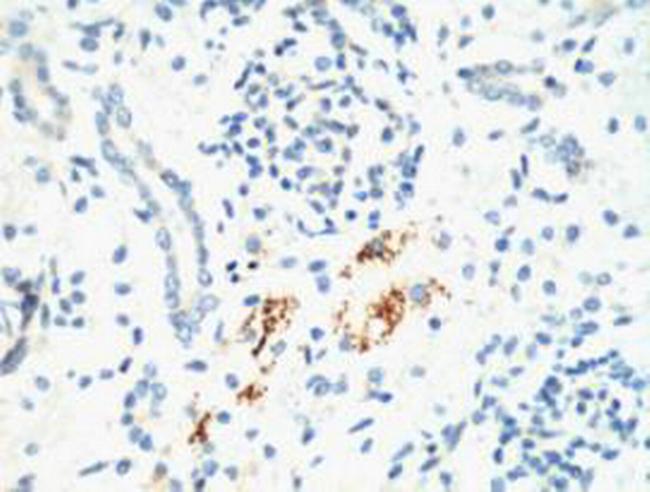 KIF7 Antibody in Immunohistochemistry (IHC)