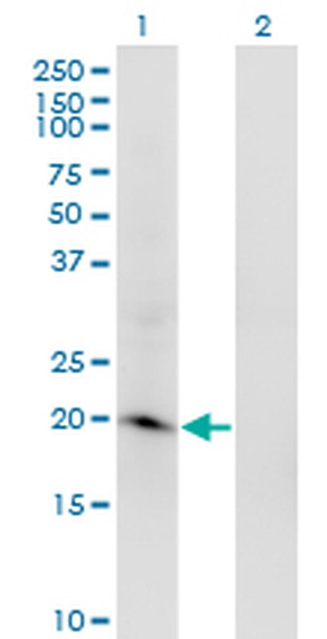 ARL2BP Antibody in Western Blot (WB)