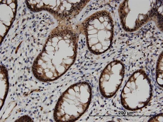 ACOT7 Antibody in Immunohistochemistry (Paraffin) (IHC (P))