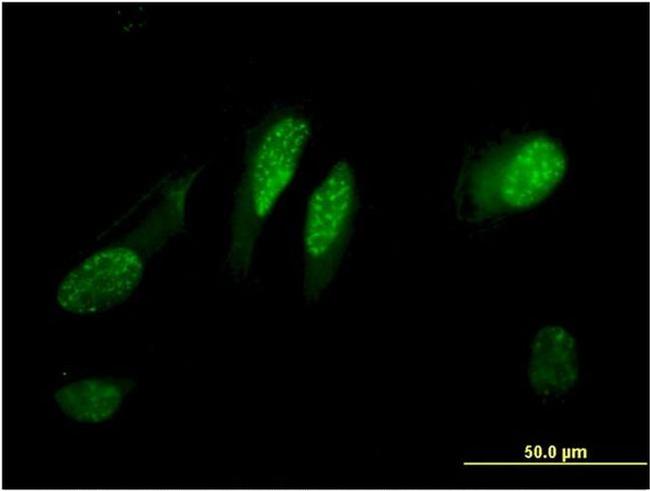 C13orf15 Antibody in Immunocytochemistry (ICC/IF)