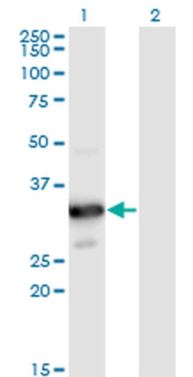 MYOZ2 Antibody in Western Blot (WB)