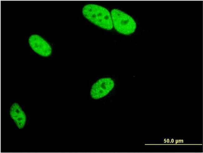 MED25 Antibody in Immunocytochemistry (ICC/IF)