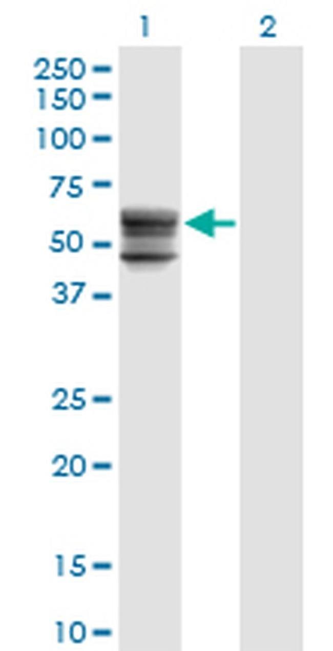 CHST12 Antibody in Western Blot (WB)