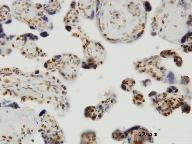 THUMPD1 Antibody in Immunohistochemistry (Paraffin) (IHC (P))