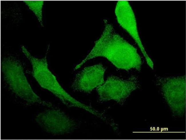 PUS1 Antibody in Immunocytochemistry (ICC/IF)