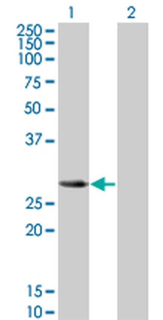 SLA2 Antibody in Western Blot (WB)