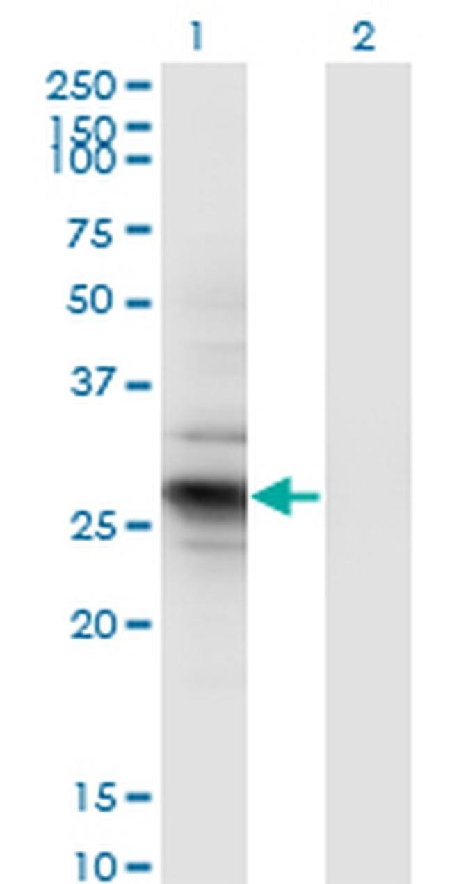 IDI2 Antibody in Western Blot (WB)