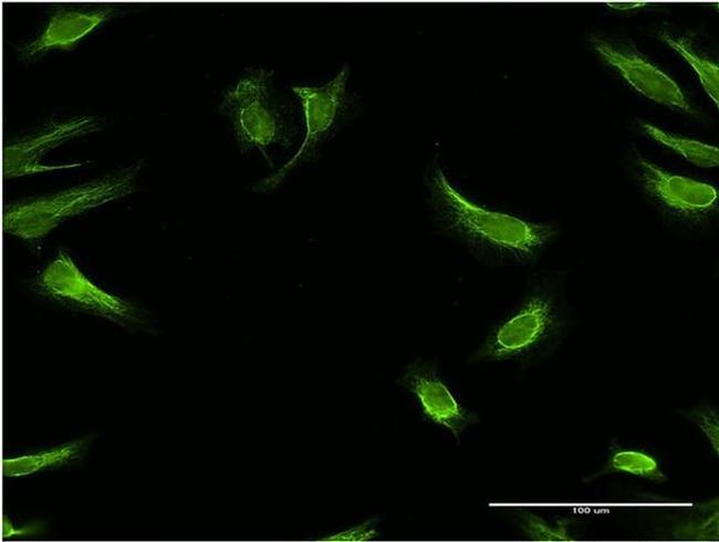 RBP7 Antibody in Immunocytochemistry (ICC/IF)