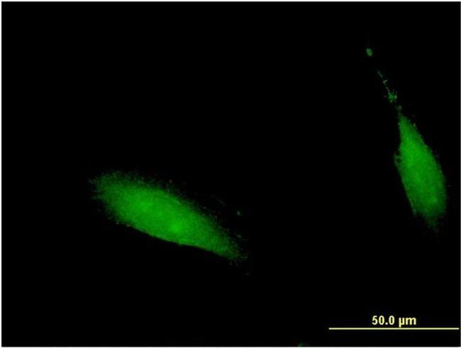 CENPV Antibody in Immunocytochemistry (ICC/IF)