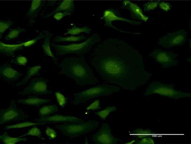 MTMR3 Antibody in Immunocytochemistry (ICC/IF)