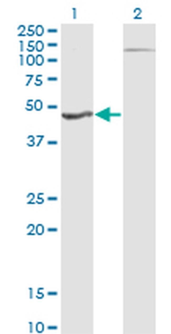 HGD Antibody in Western Blot (WB)