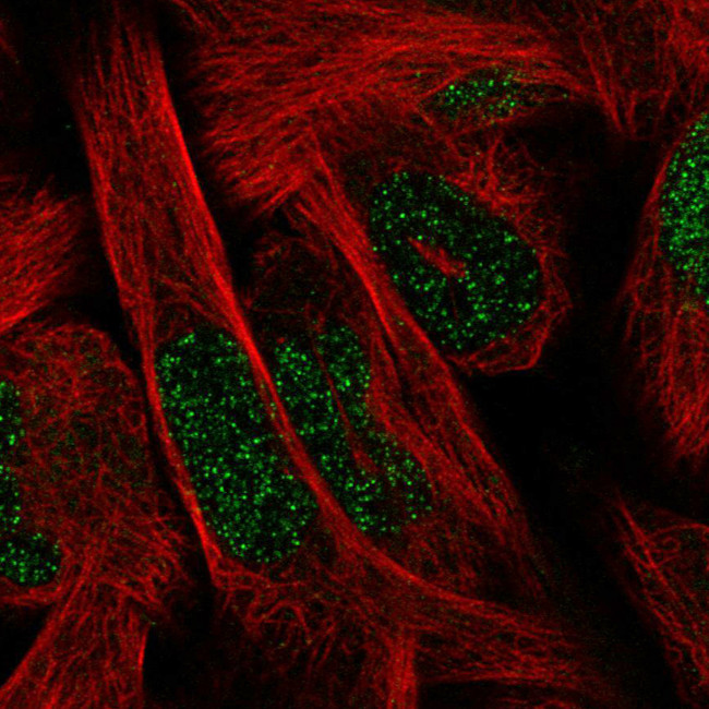 SIX1 Antibody in Immunocytochemistry (ICC/IF)