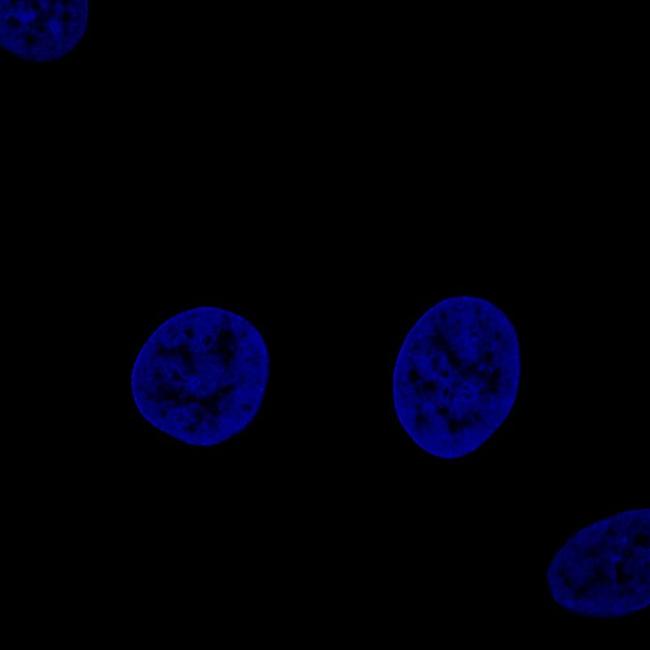 Fibulin 1 Antibody in Immunocytochemistry (ICC/IF)