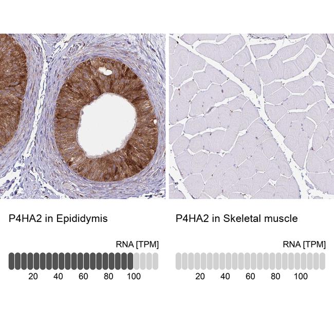 P4HA2 Antibody in Immunohistochemistry (IHC)