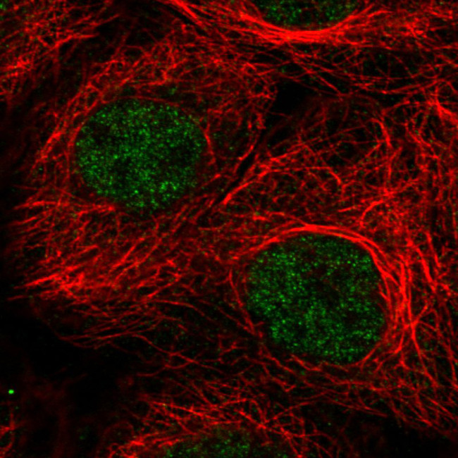 ATRX Antibody in Immunocytochemistry (ICC/IF)