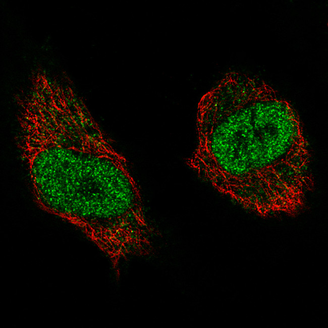 NSD2 Antibody in Immunocytochemistry (ICC/IF)