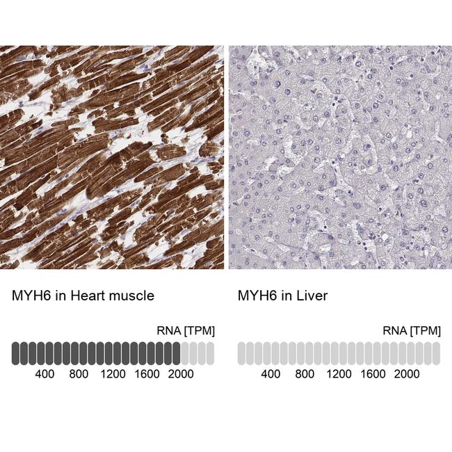 MYH6 Antibody in Immunohistochemistry (IHC)