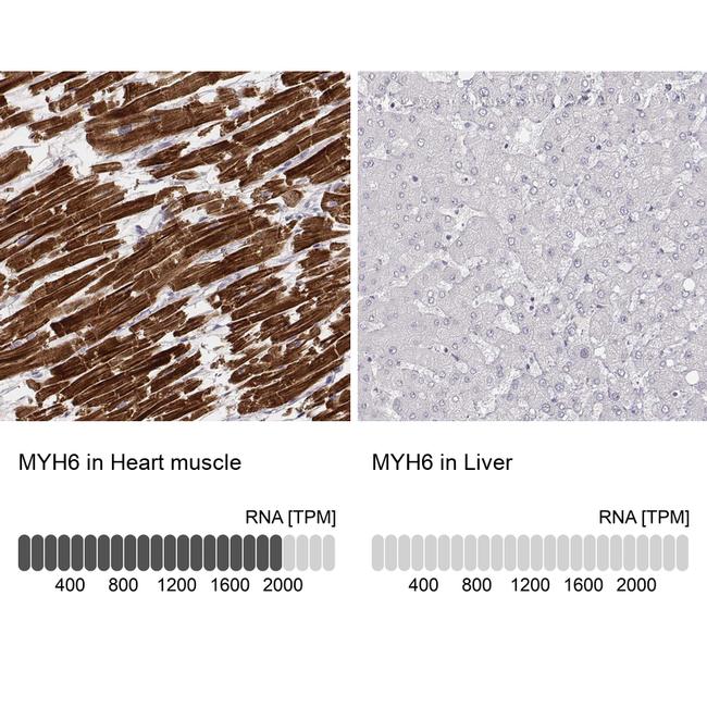 MYH6 Antibody in Immunohistochemistry (IHC)