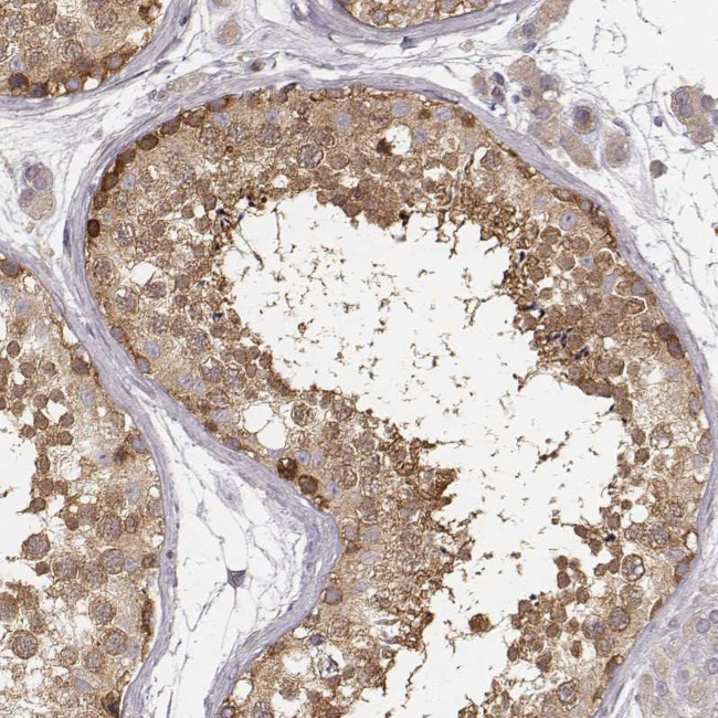 CARS Antibody in Immunohistochemistry (Paraffin) (IHC (P))