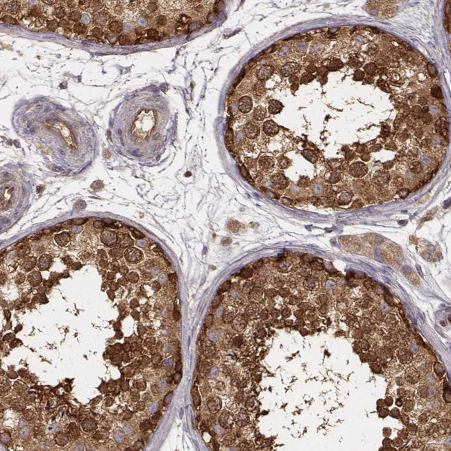 CARS Antibody in Immunohistochemistry (Paraffin) (IHC (P))